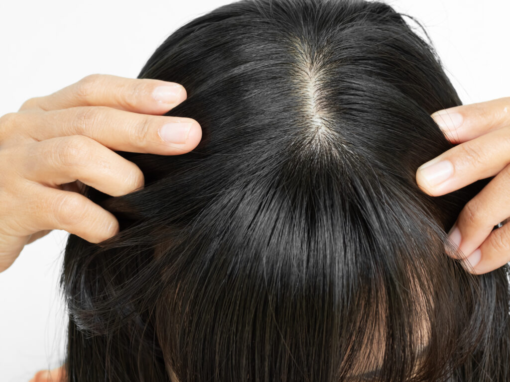 Why a Healthy Scalp Matters for Your Hair Growth! Cover Image PT2 124342