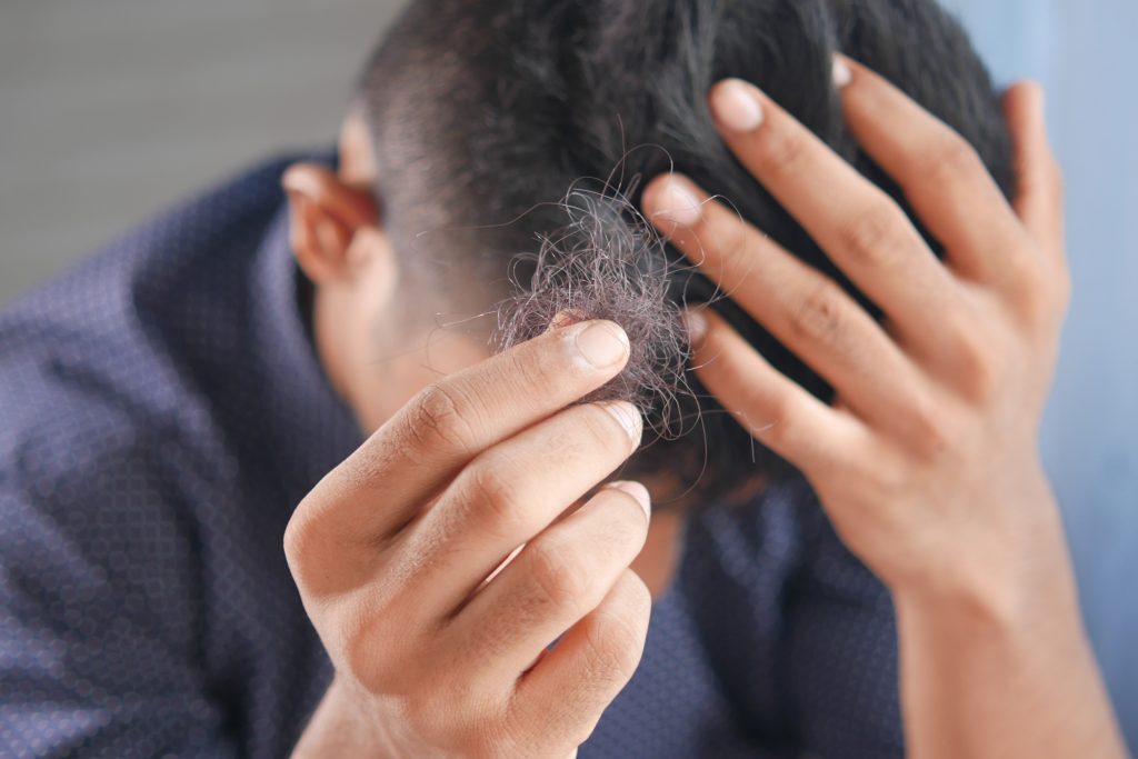 Hair Fall vs Hair Shedding! Featured Image 00125